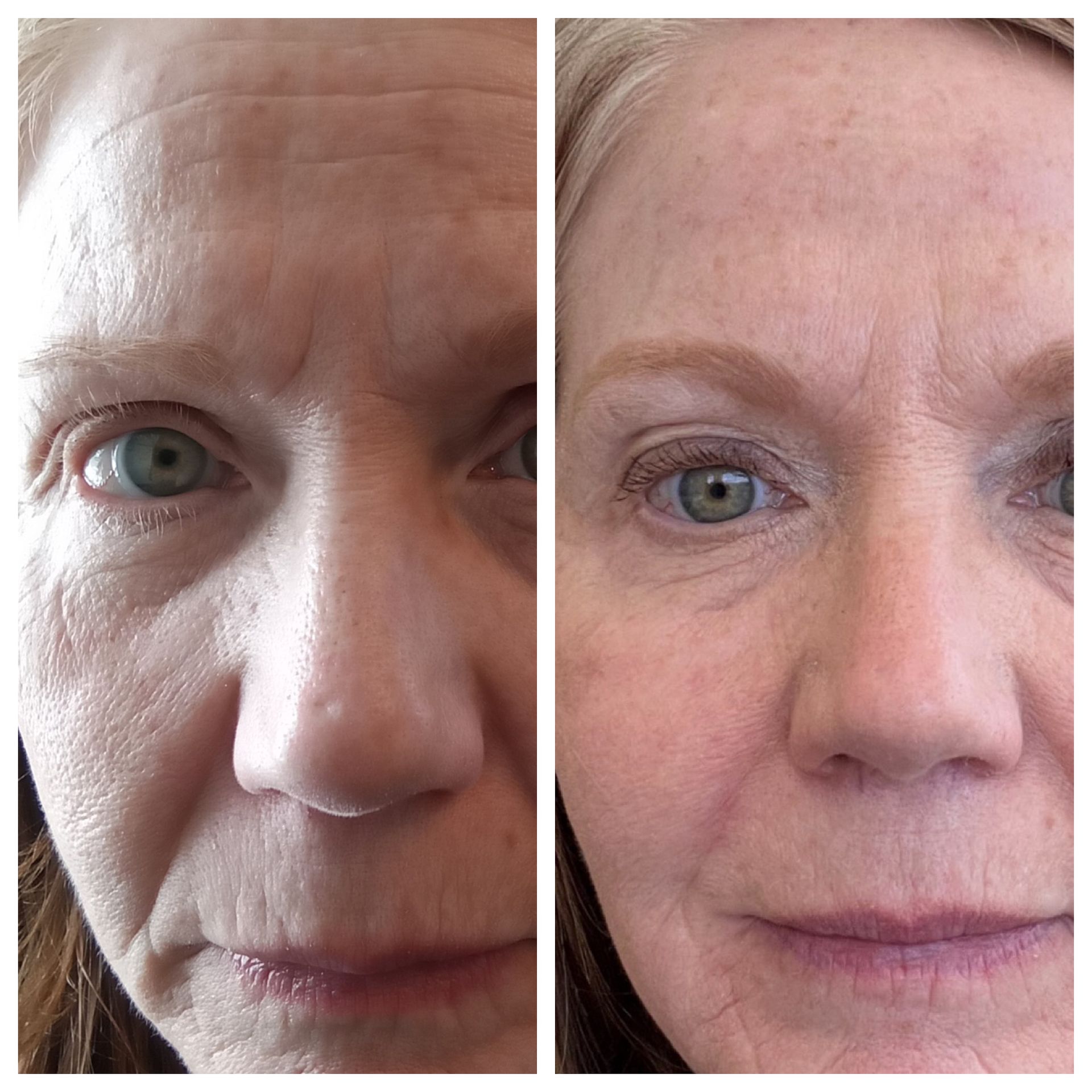 A before and after photo of a woman 's face.