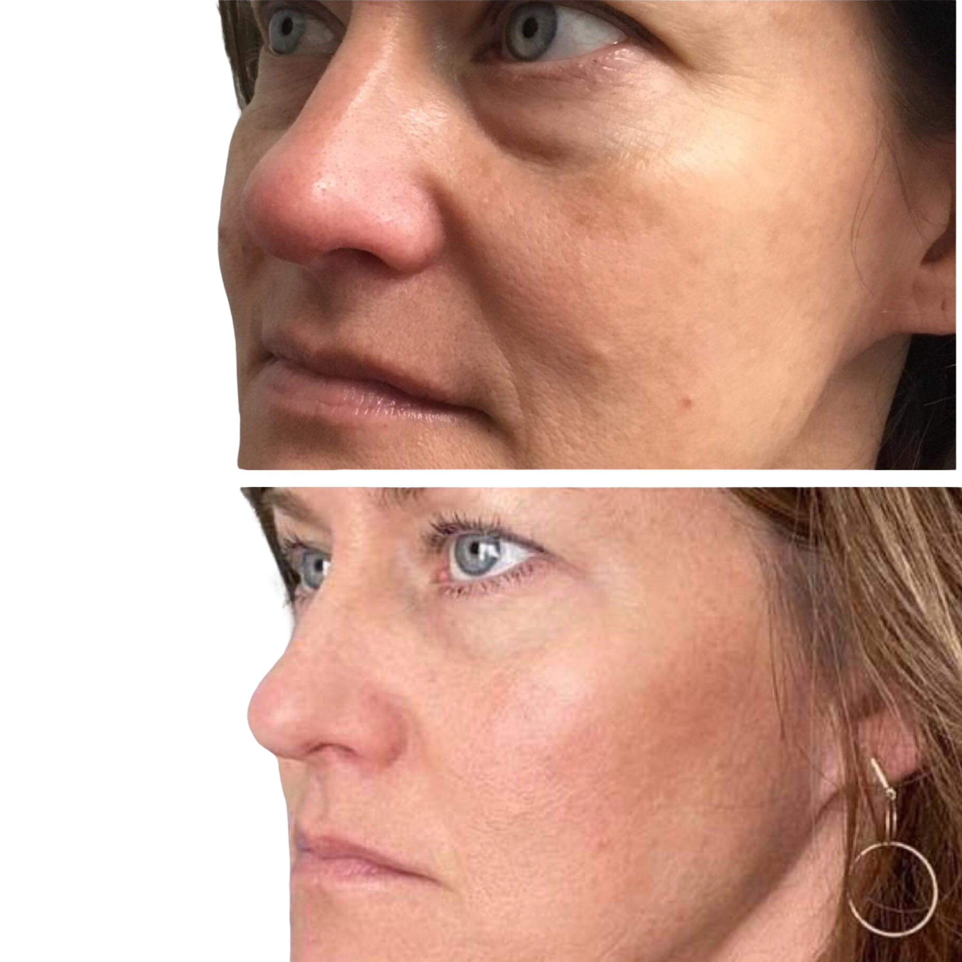 A before and after photo of a woman 's face.