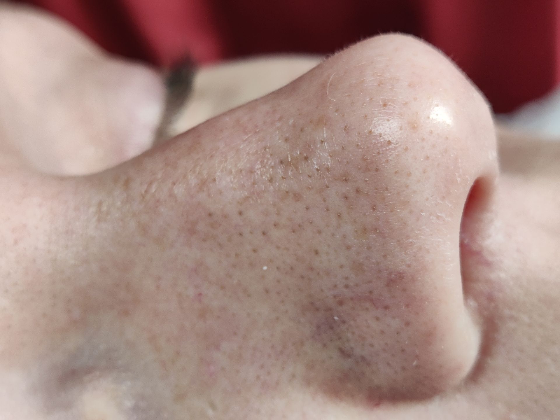 Close-up of a person's nose, showing visible pores and texture on the skin.