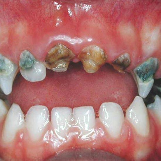 HAPPY KIDS TJ DENTAL - ATENCION DENTAL