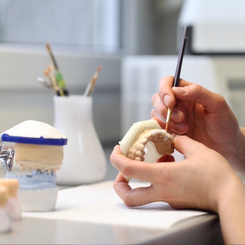 costruzione di impianti dentali