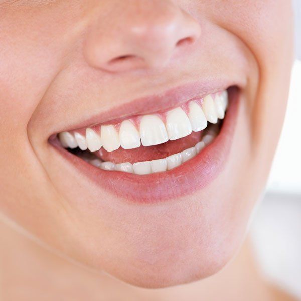 estetica dentale