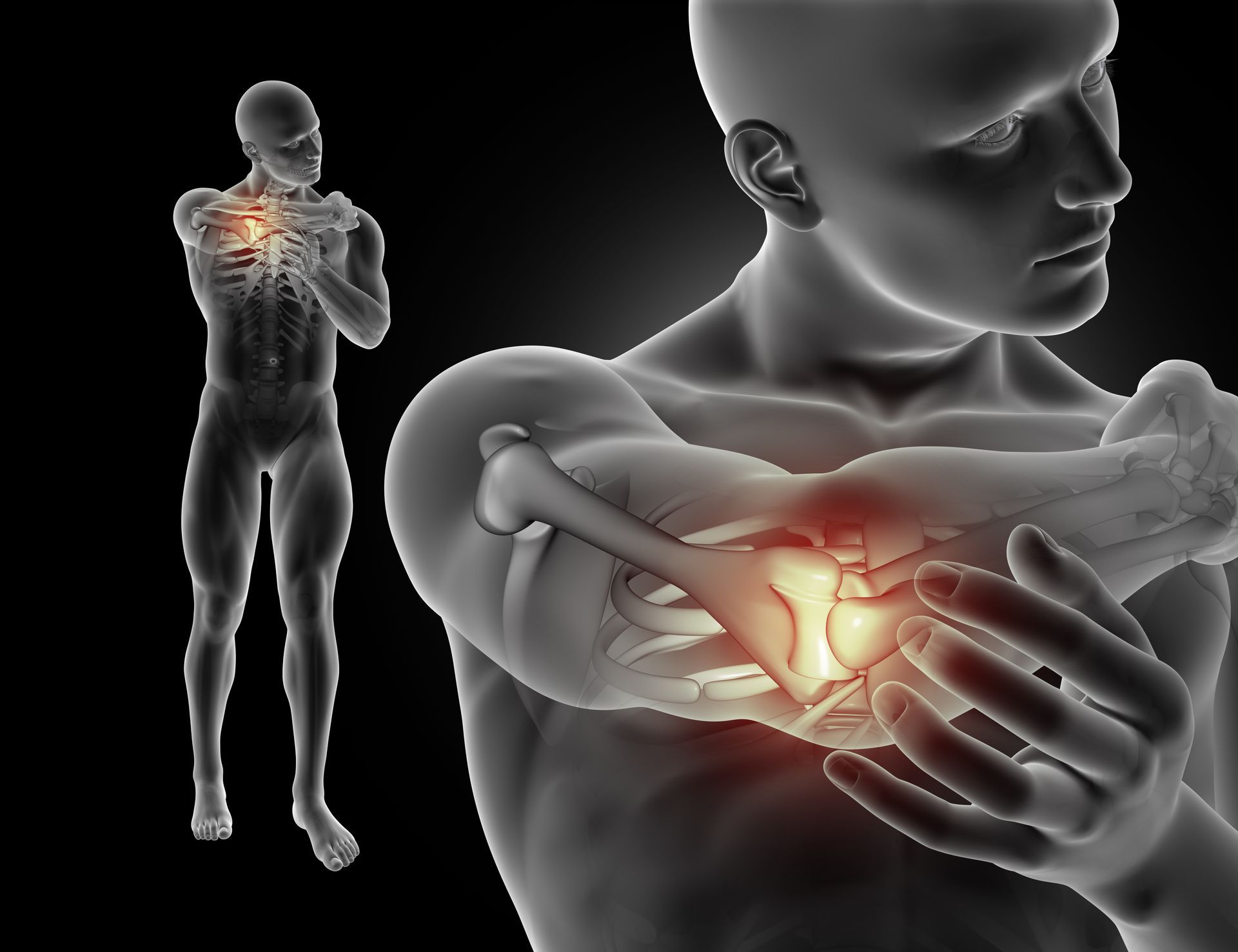 acute inflammation