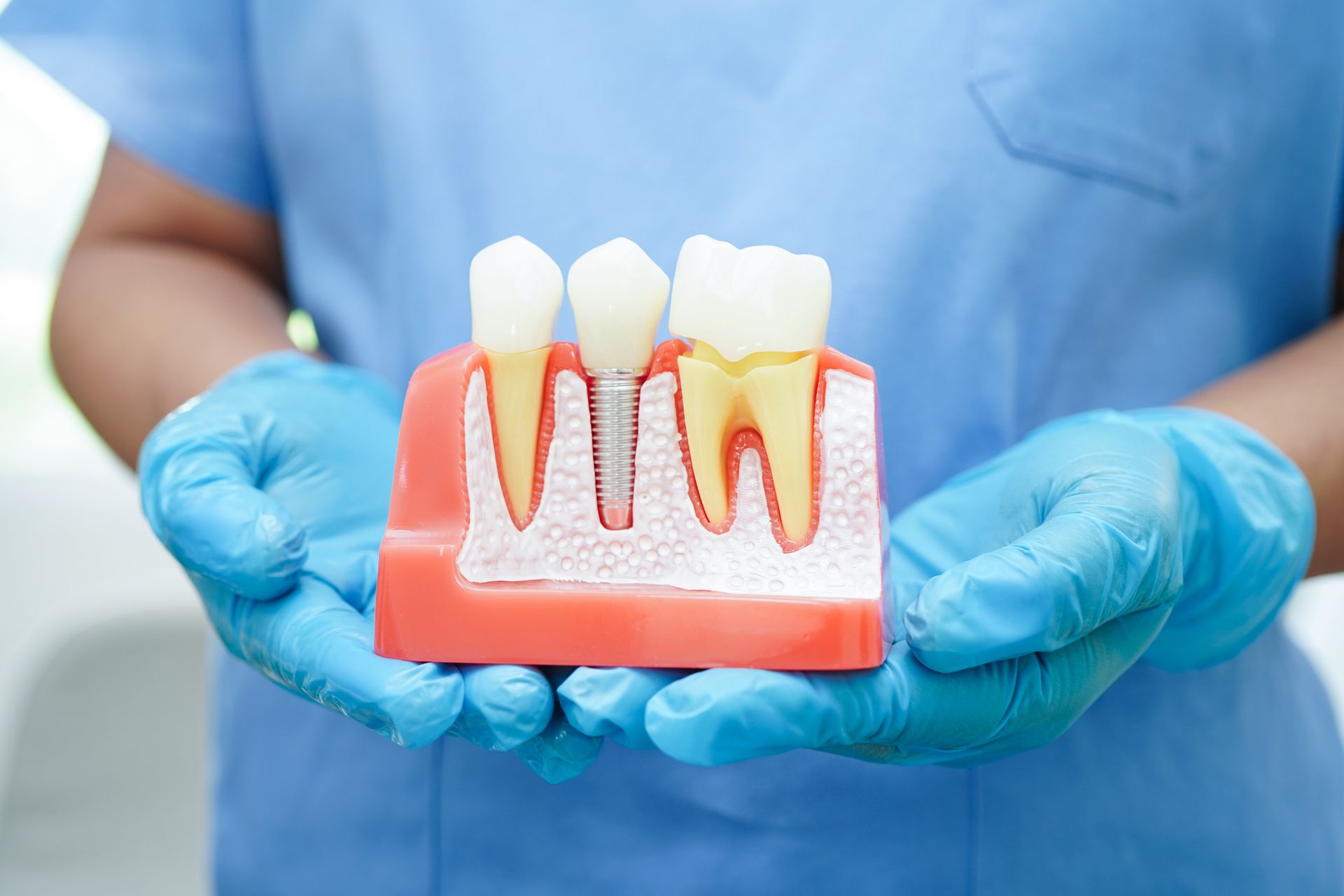 Gloved hands holding a dental model showing teeth, gums, and roots in a clinic setting