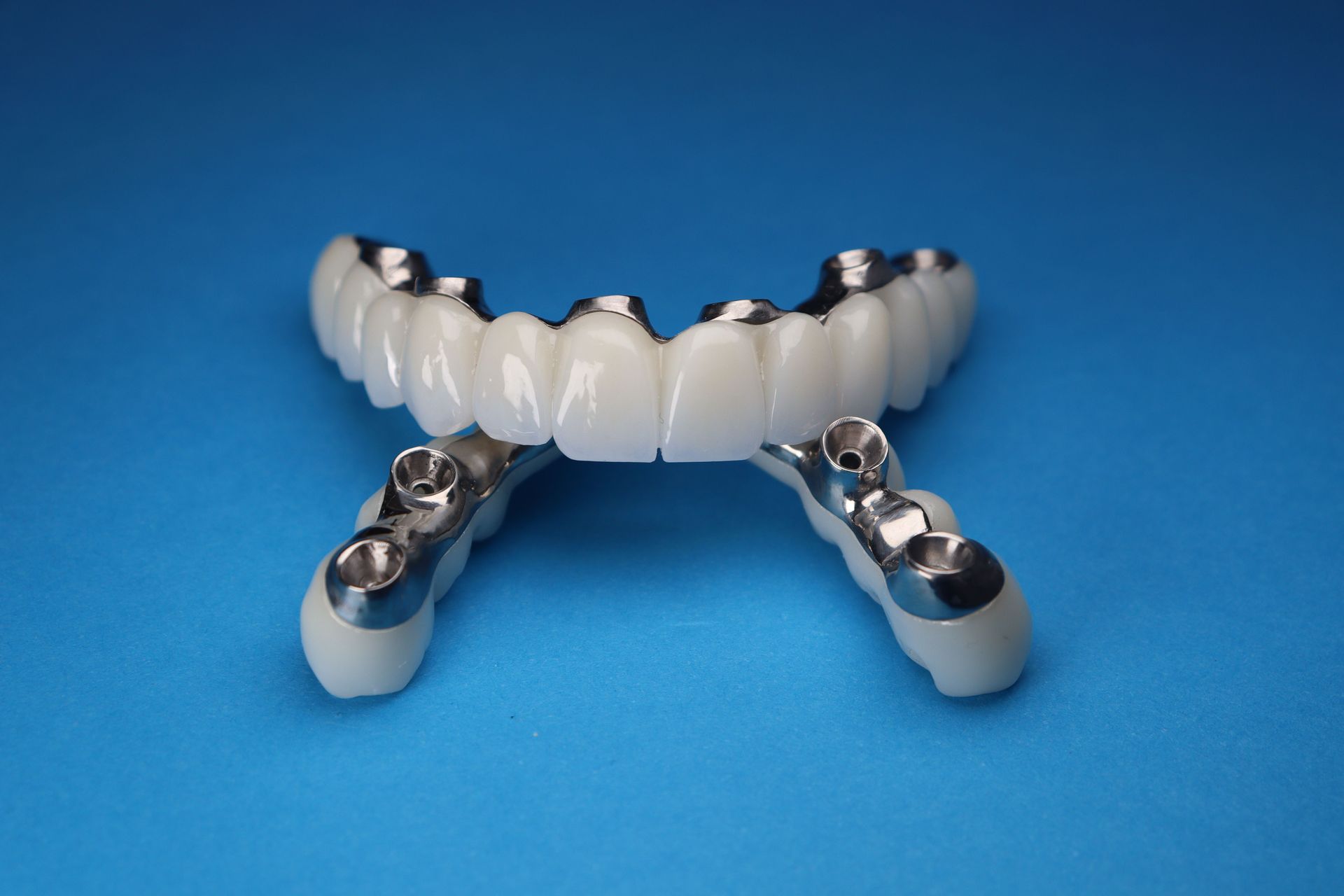 Full-arch implant-supported prosthesis on four implant abutments, San Jose CA
