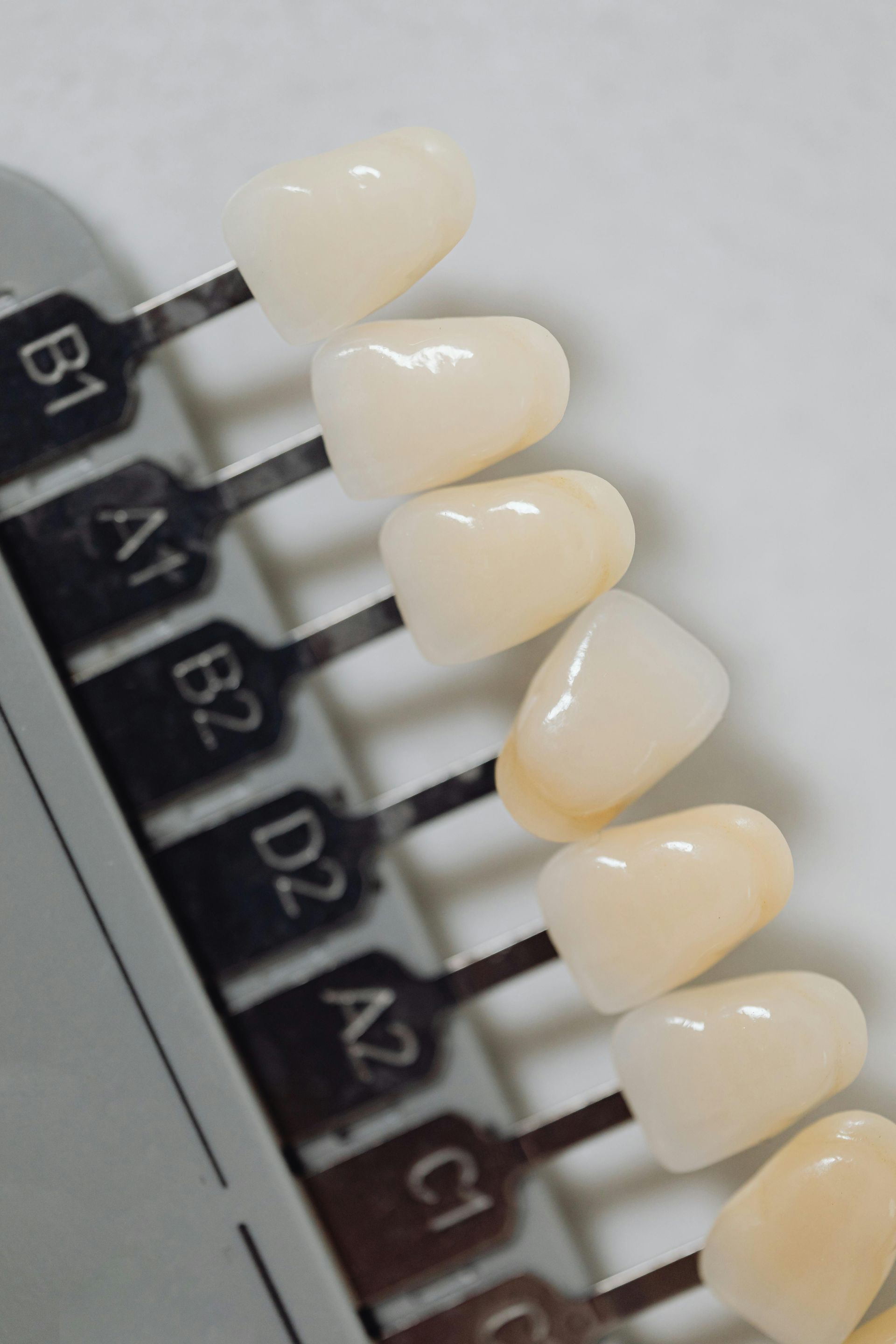 Close-up of a dental shade guide with ivory-colored tooth samples on labeled tabs.