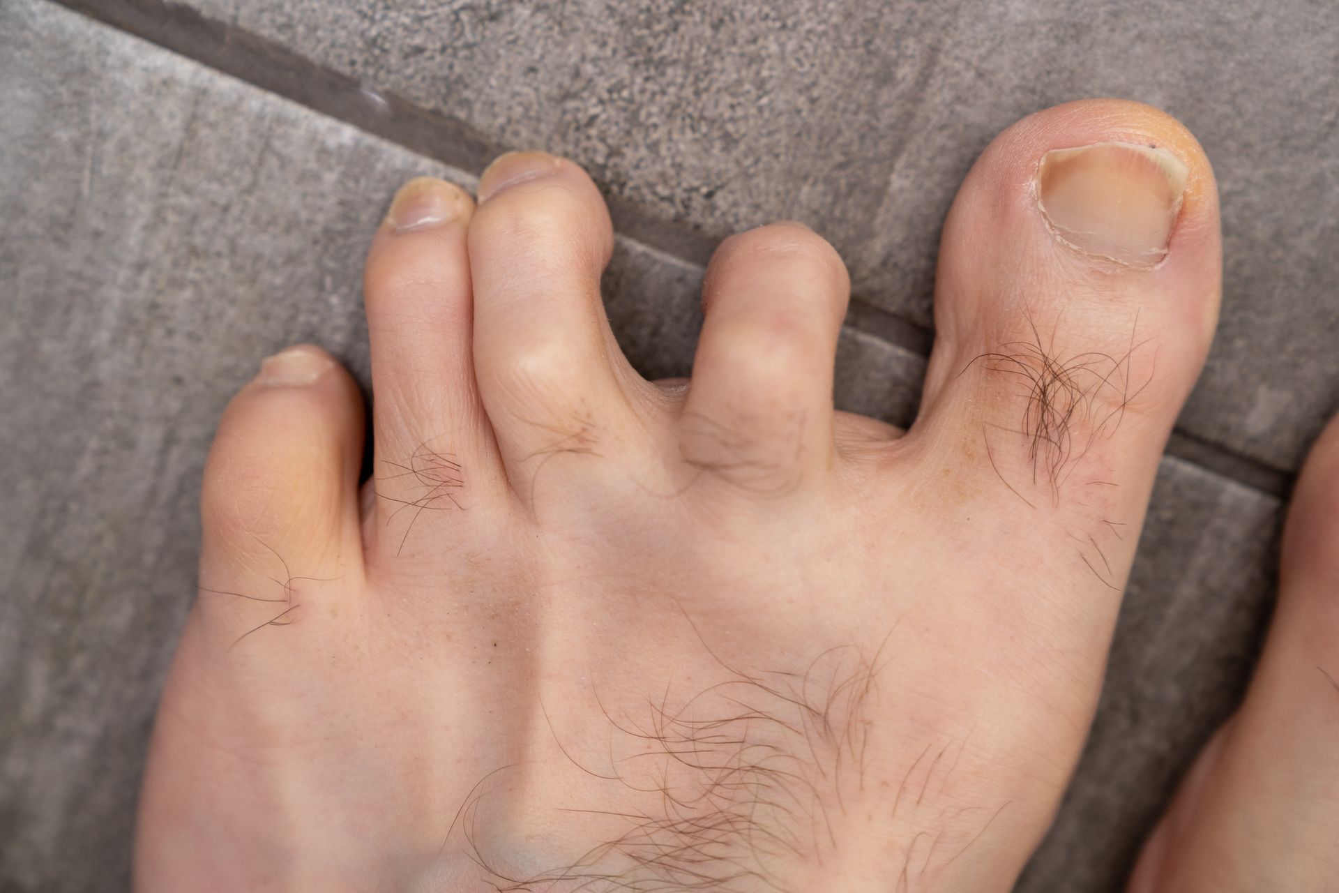 Close-up of a human foot with all five toes visible against a gray tiled floor.