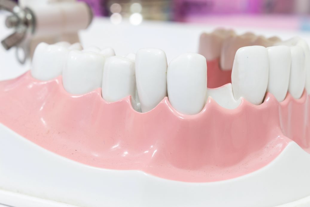 A close up of a model of teeth on a table.