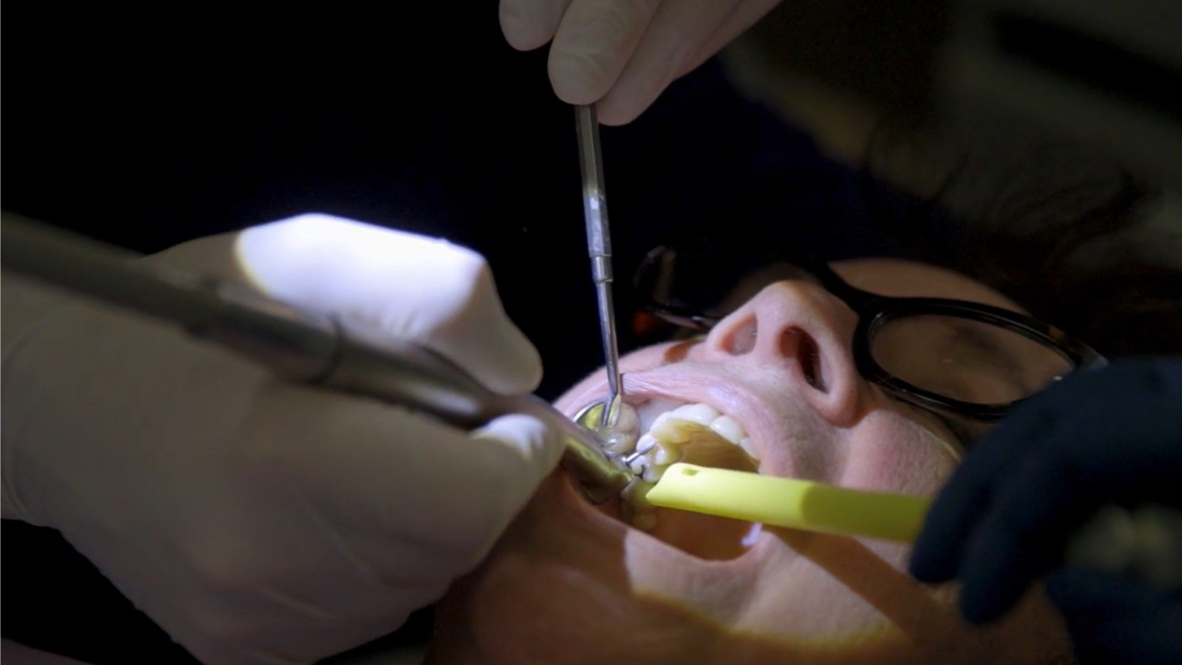 A woman is getting her teeth examined by a dentist.
