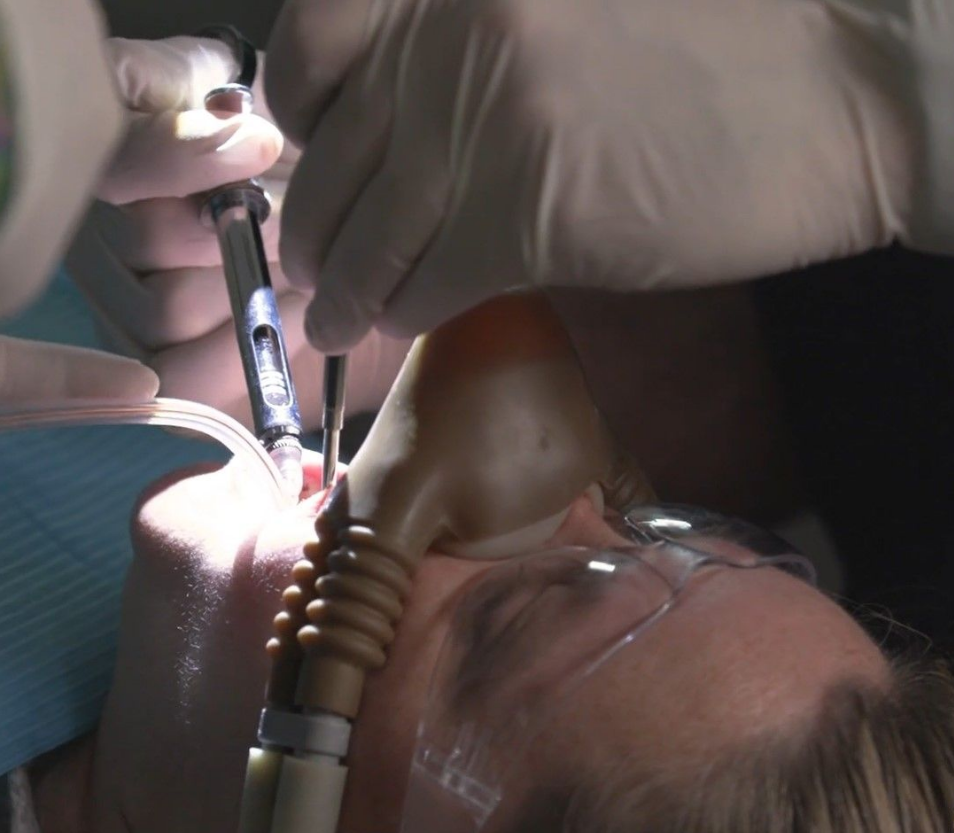 A patient is wearing a sedation mask and getting dental work done near Garner, NC