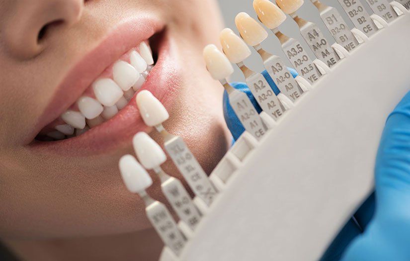 A woman is getting her teeth whitened by a dentist.