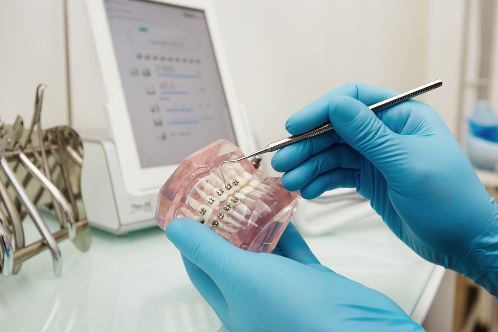 A Dentist Is Examining A Model Of Teeth With Braces — Buderim Denture Studio In Buderim, QLD