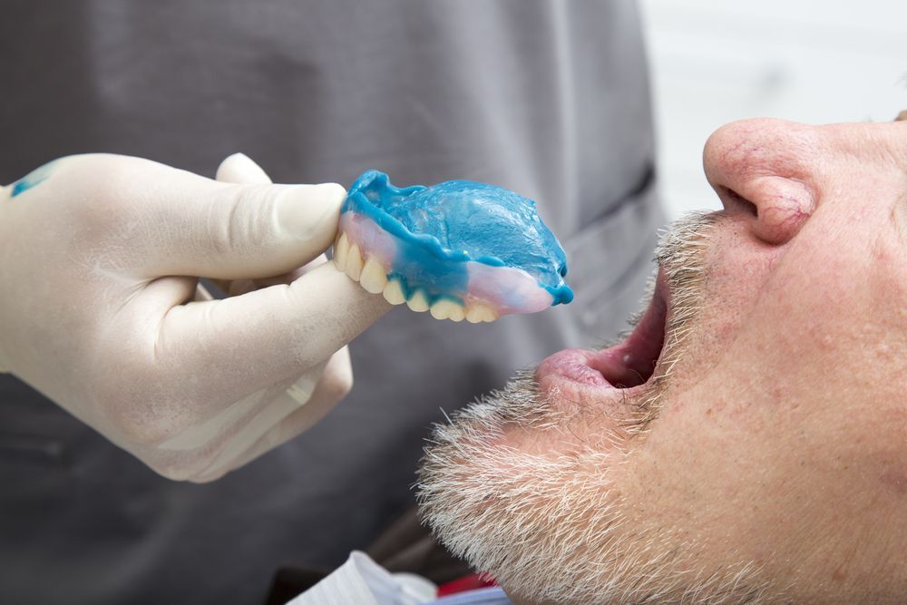 A Man Is Getting A Denture Made By A Dentist — Buderim Denture Studio In Buderim, QLD