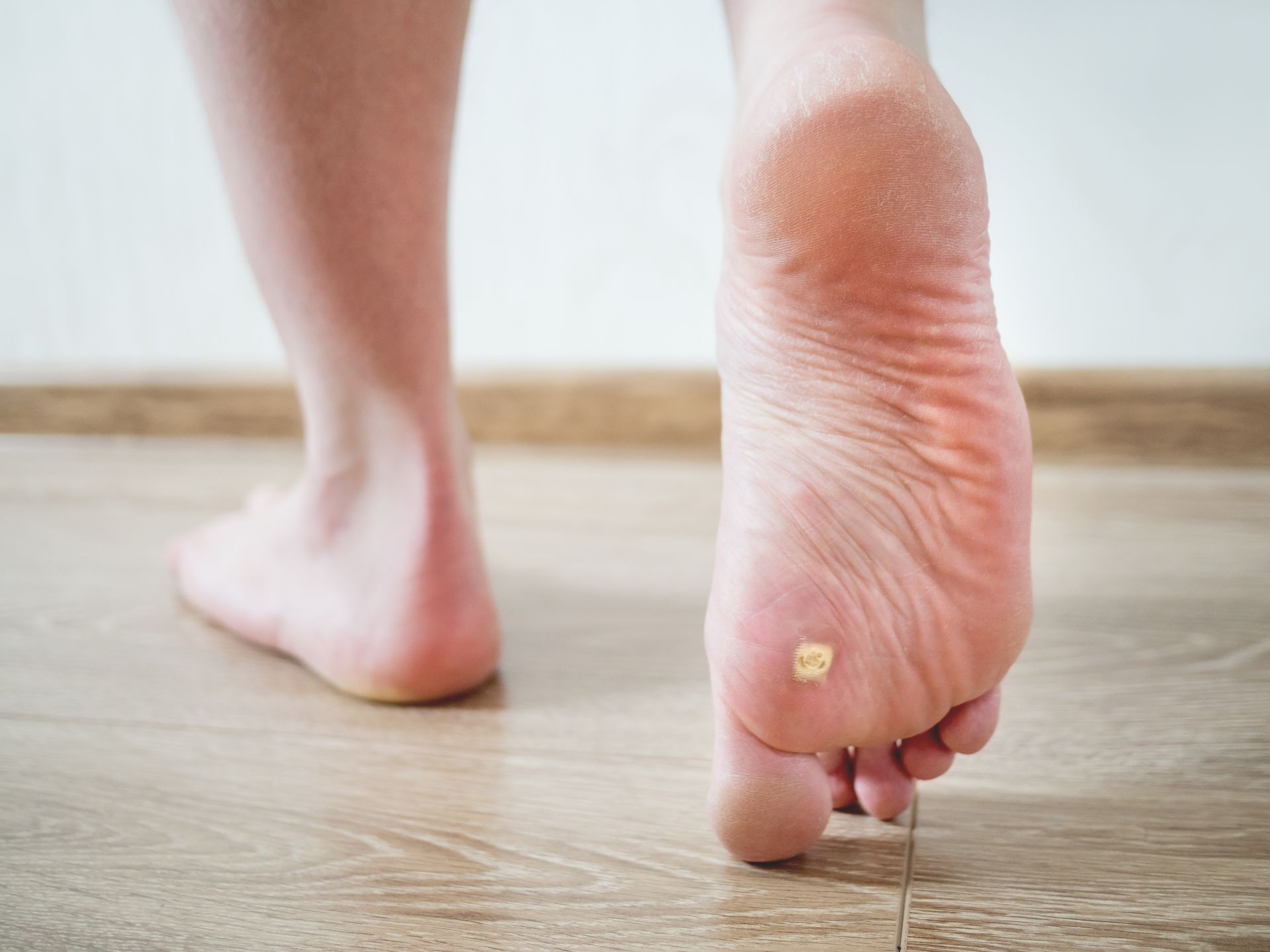Bare feet on a wooden floor, focus on sole of one foot with a small bandage, indicating a foot injury.