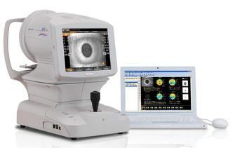 Eye care follow-up service