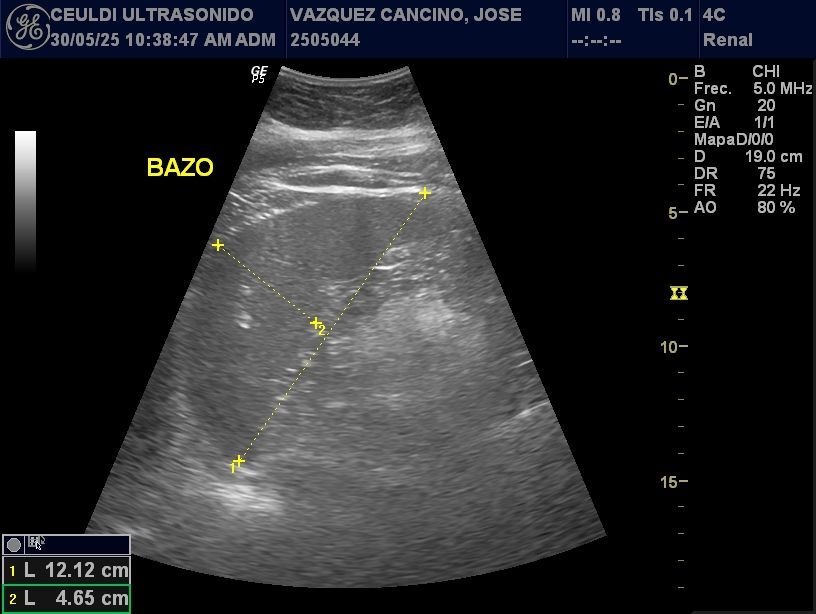 BAZO