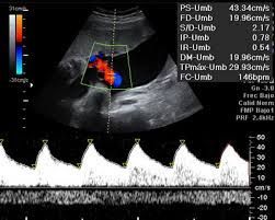 HEMODINAMIA DE CORDON UMBILICAL