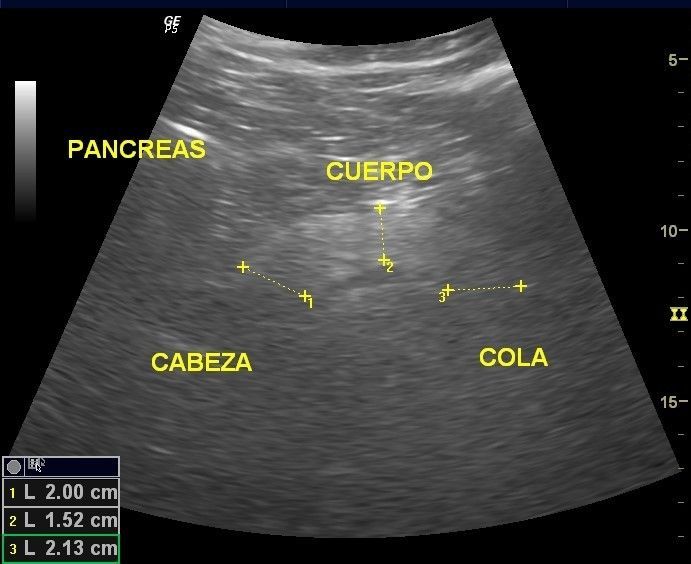 PANCREAS