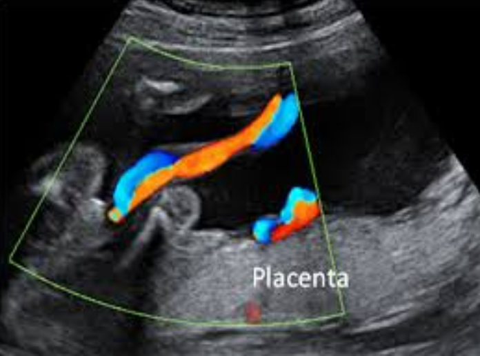 PLACENTA