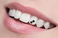 black tooth gem
