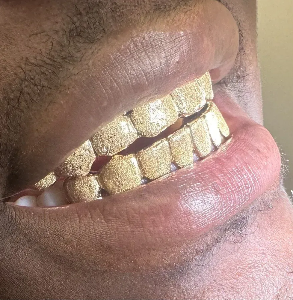 shiny gold grillz