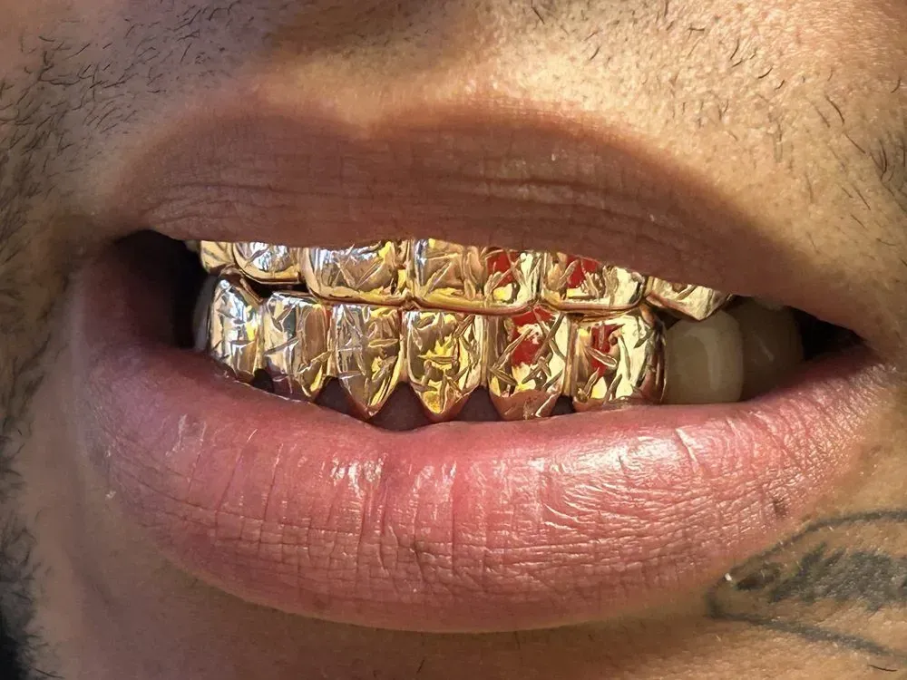 gold grill top and bottom