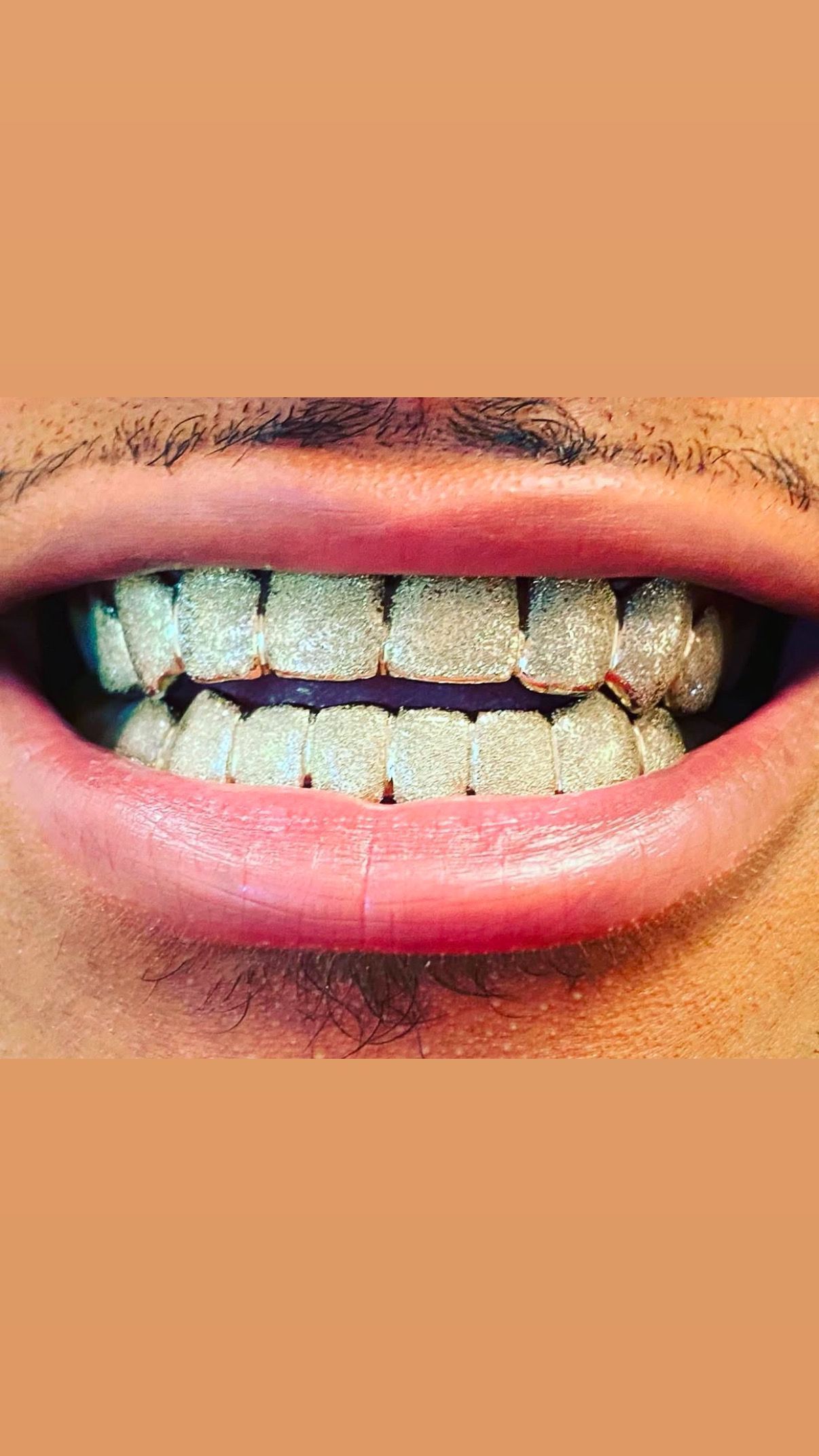 silver grillz