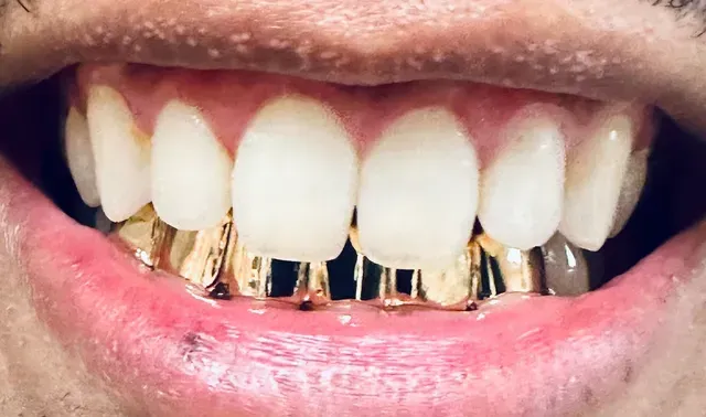 gold grill bottom