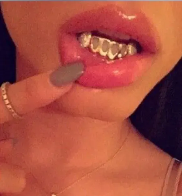 girls with custom gold grill