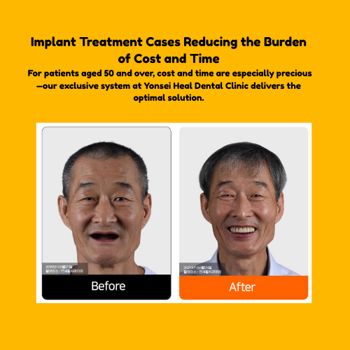 Before and after dental implant photos of an Asian man. He's smiling in the