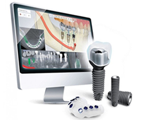 Computer screen showing dental implant planning, with implants and a guide in front.