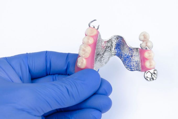 Mano guantata che regge una protesi parziale trasparente con gengive artificiali rosa e denti bianchi su sfondo bianco.