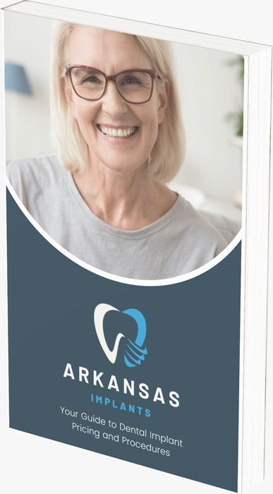 A woman wearing glasses is smiling on the cover of a book about dental implants.