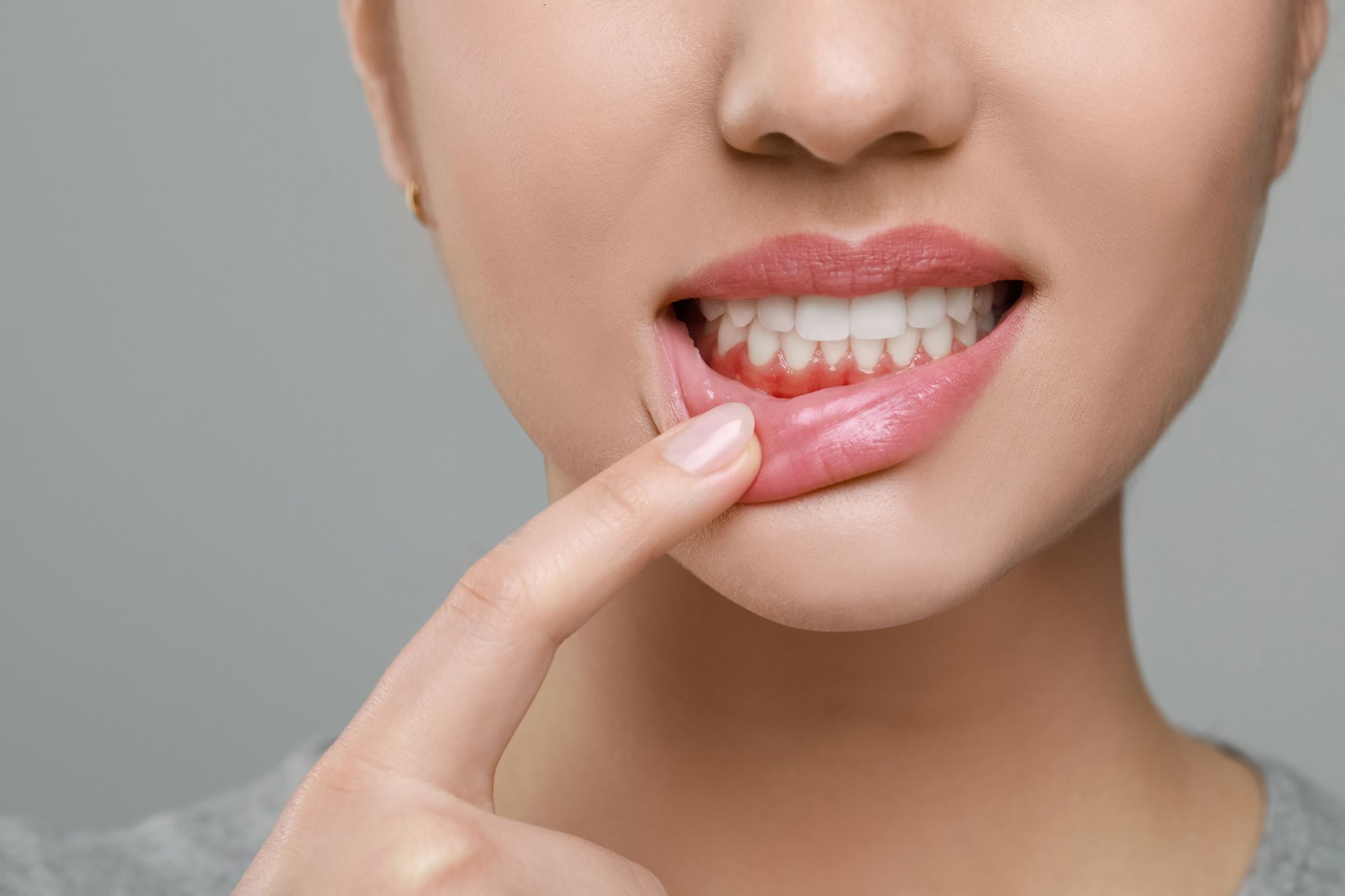 Close-up of a person pulling down their lower lip to reveal red, swollen gums.