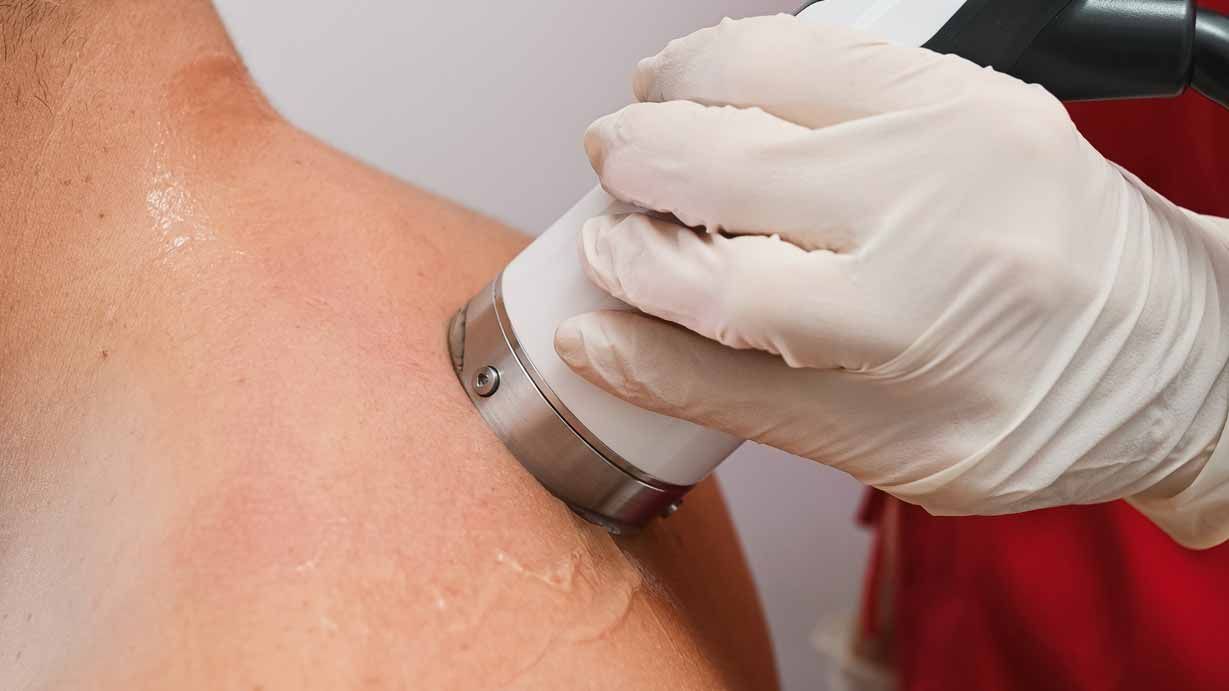 Gloved clinician using a handheld device on a patient’s shoulder during a skin treatment