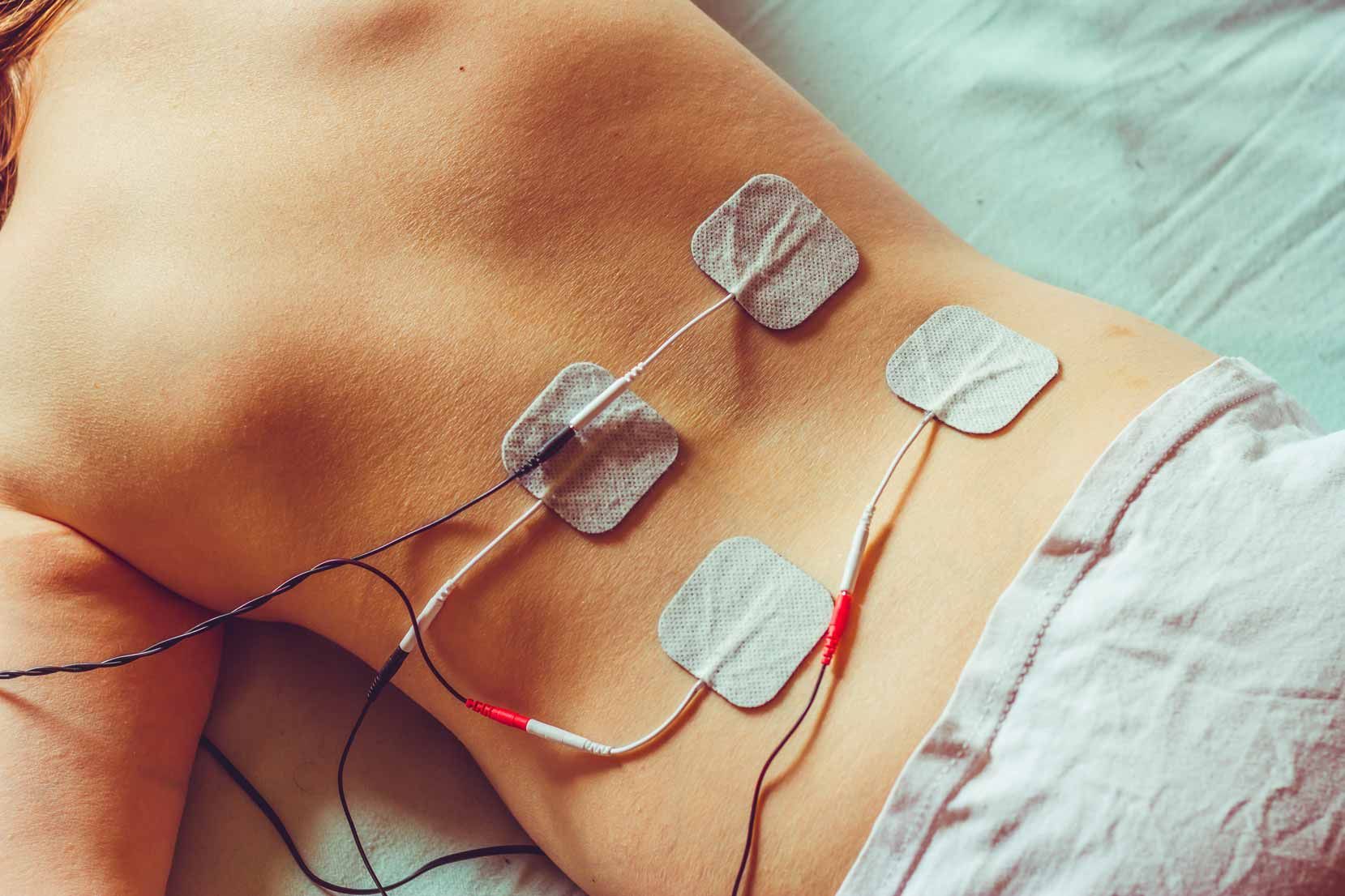 Torso with adhesive ECG pads and wires attached to skin on a hospital bed