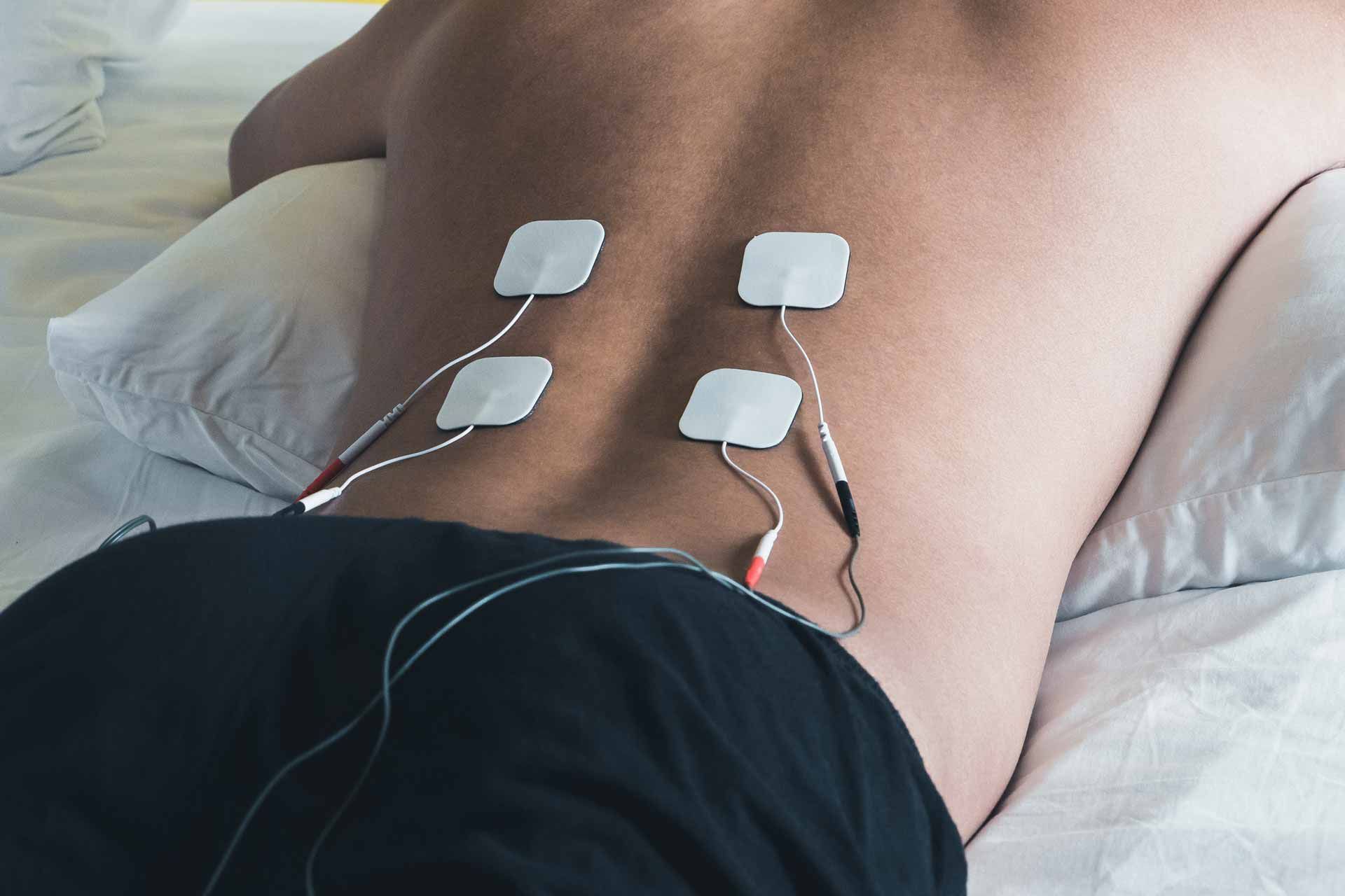 Person lying on a bed with four electrode pads attached to the lower back, with wires connected to a device.