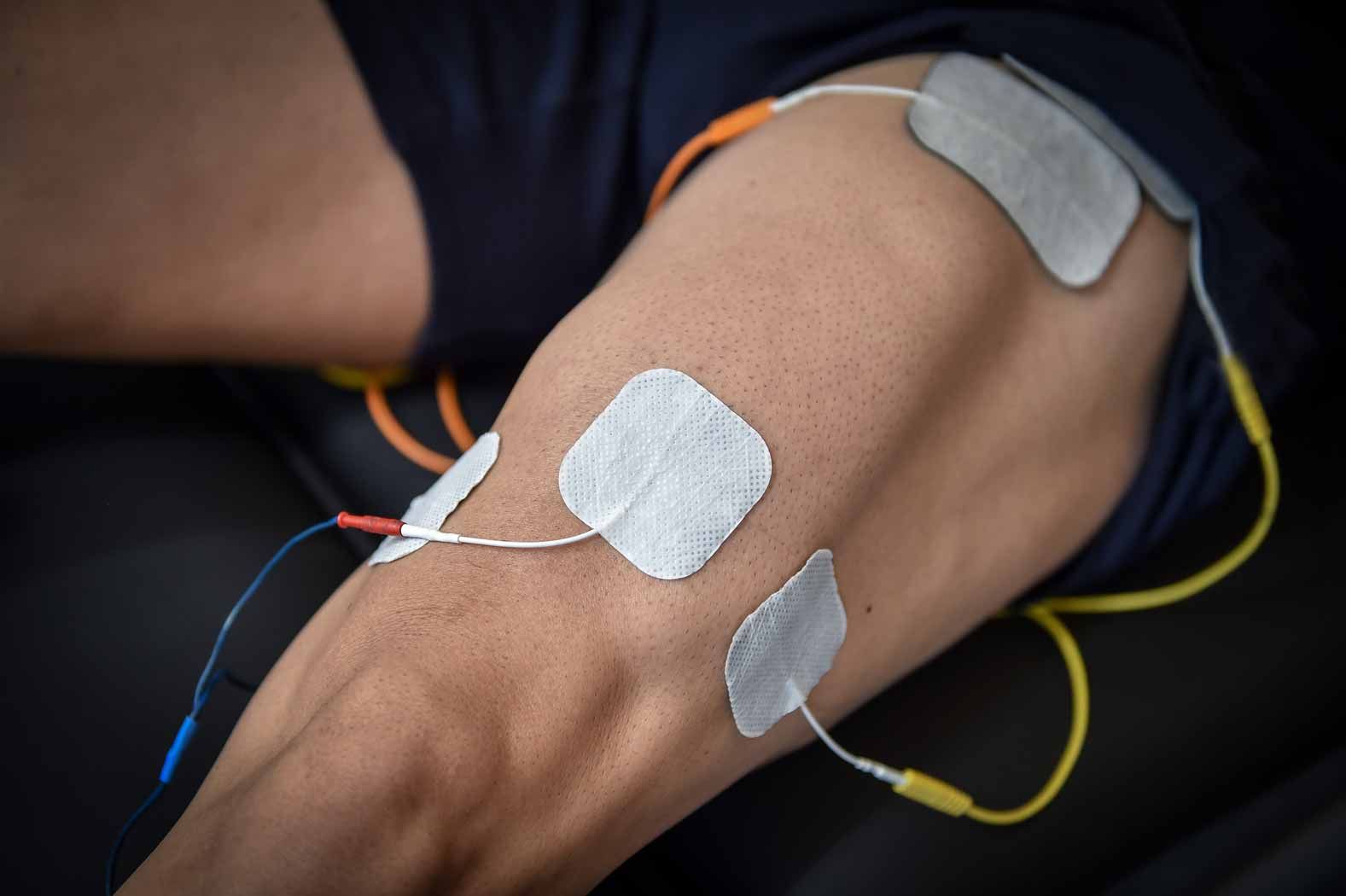 Close-up of an arm with adhesive sensor pads and wires attached for medical monitoring