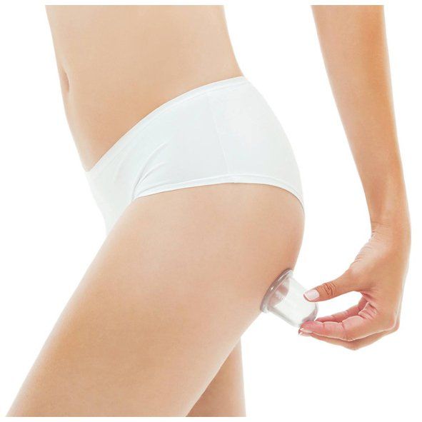 Cupping Orangerie Agnes Raskin – cupping en FIT Bodywrap Lommel - resultaten