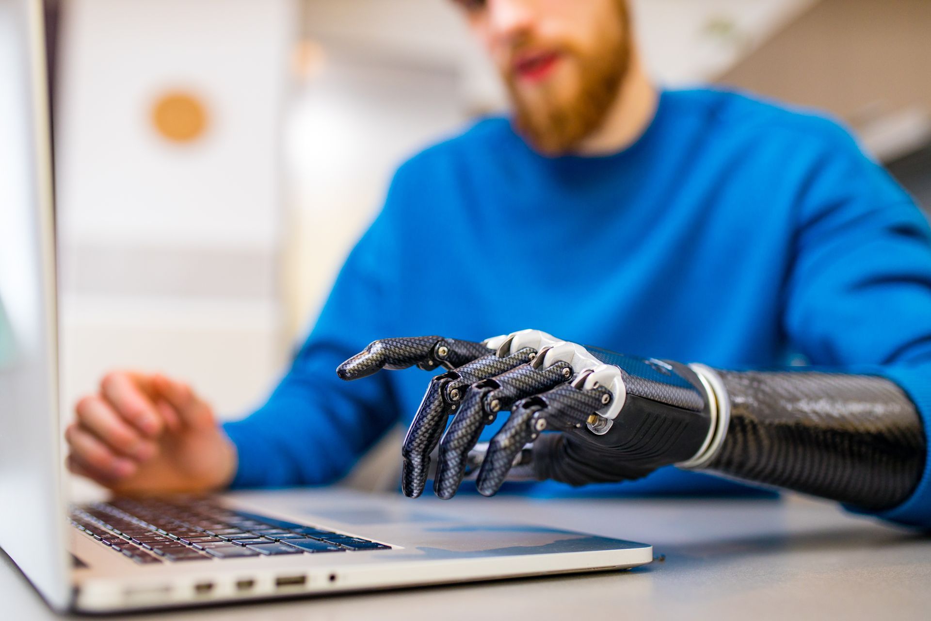 Man with a prosthetic hand uses a laptop, typing. Blue shirt, seated at a table, indoors.