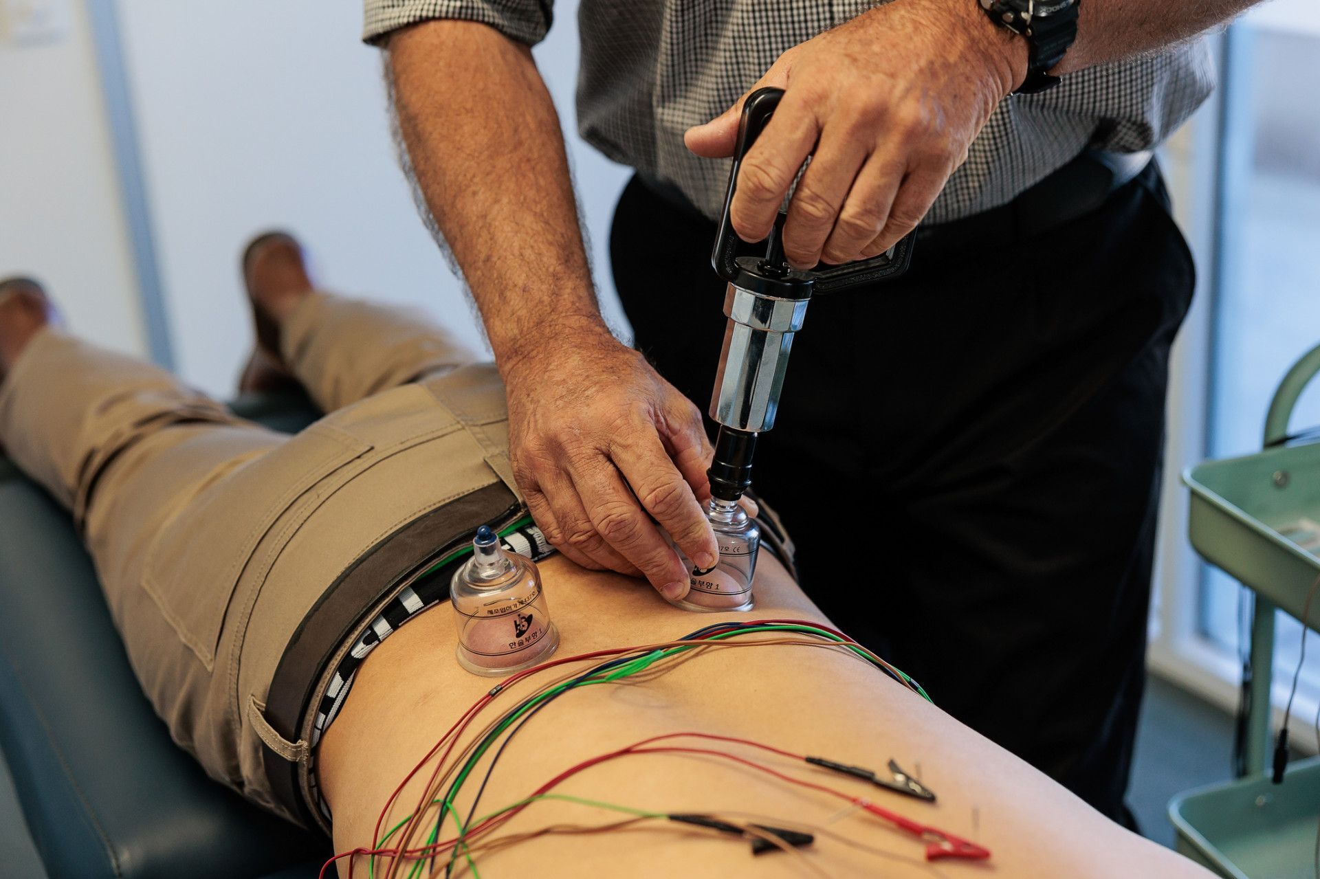 Person Receiving Cupping Therapy and Electroacupuncture on Lower Back — Grays Chiropractic & Wellness In Ooralea, QLD