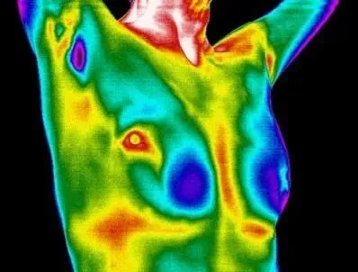 Breast Cancer Screening