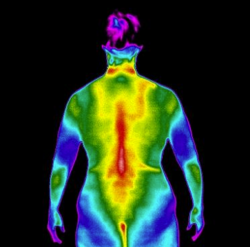 Upper Body Thermography