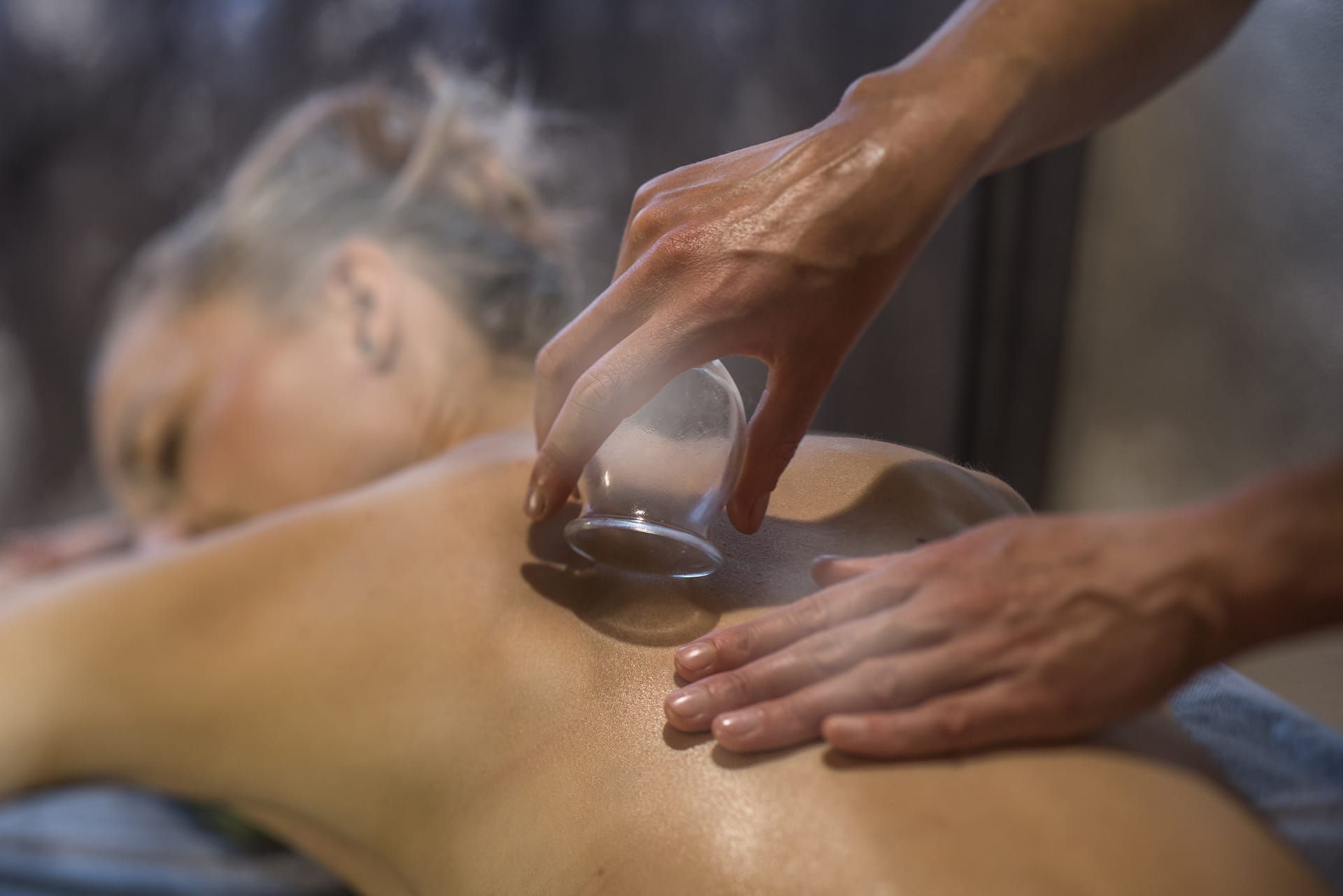 Person receiving cupping therapy on their back, hands applying cups.