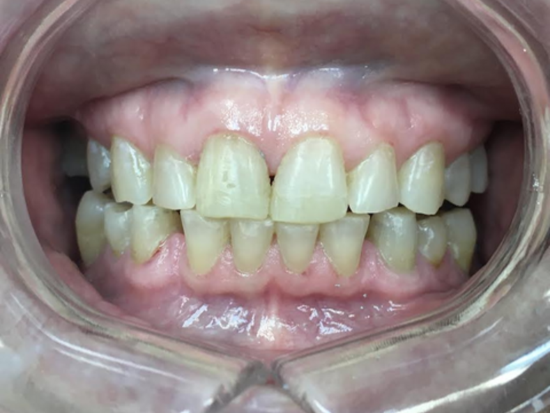 after patient