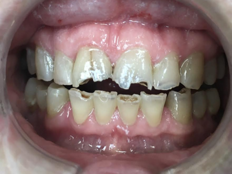 before patient