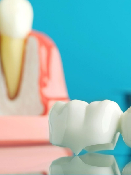 White dental crown model on turquoise background with blurred tooth diagram in back