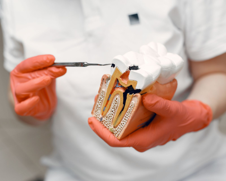 Gloved hands using a dental tool on a tooth cross-section model