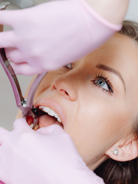 Dentist examining a patient’s open mouth with gloved hands and dental tools, close-up view