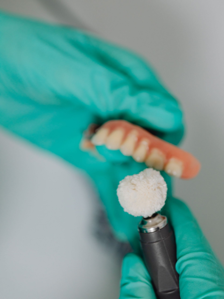 Gloved hand holding a dental mold and rotary tool with white polishing compound